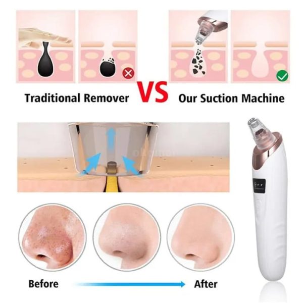 Face Vacuum Suction Blackhead Remover – Electric Deep Cleansing Tool for Nose & Face