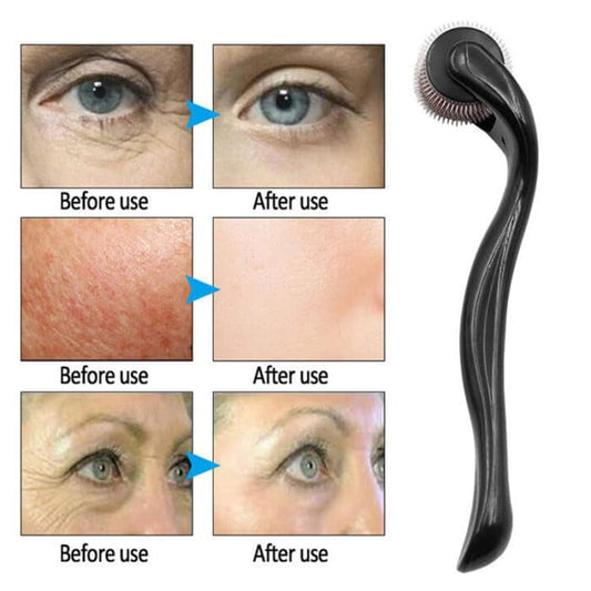 540 Derma Roller – Hair Growth, Beard & Skin Care Micro-Needle Treatment
